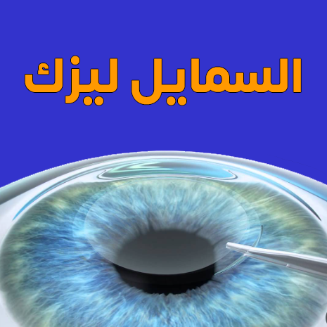 صورة لعملية السمايل ليزك لتصحيح النظر في إسطنبول