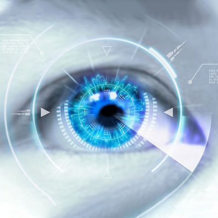 صورة لجراحة الليزك لتصحيح النظر في إسطنبول