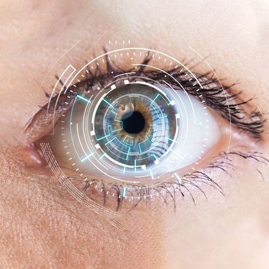 صورة لعملية PRK أو NO TOUCH LASER لتصحيح قصر النظر في إسطنبول